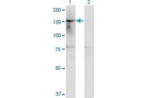 Western Blot analysis of HDAC6 expression in transfected 293T cell line by HDAC6 monoclonal antibody (M01), clone 1E2. (HDAC6 抗体  (AA 1128-1215))