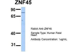 Host:  Rabbit  Target Name:  ZNF45  Sample Type:  Human Fetal Heart  Antibody Dilution:  1. (ZNF45 抗体  (N-Term))