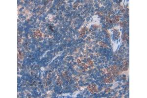 Used in DAB staining on fromalin fixed paraffin- embedded Kidney tissue (BAFF 抗体  (AA 21-169))