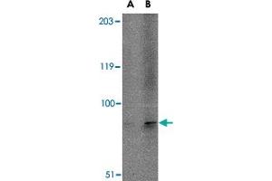 Western blot analysis of TMC6 in A-20 cell lysate with TMC6 polyclonal antibody  at (A) 1 and (B) 2 ug/mL . (TMC6 抗体  (N-Term))