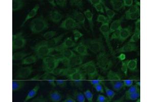 Immunofluorescence analysis of C6 cells using OSM Polyclonal Antibody at dilution of 1:100. (Oncostatin M 抗体)