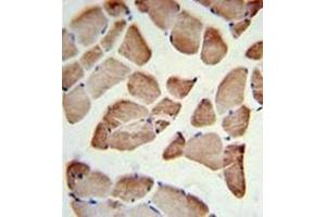 Immunohistochemistry analysis in formalin fixed and paraffin embedded skeletal muscle reacted with LFNG Antibody (Center) followed by peroxidase conjugation of the secondary antibody and DAB staining. (LFNG 抗体  (Middle Region))