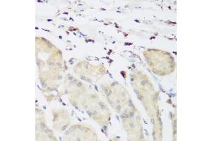 Immunohistochemistry of paraffin-embedded human stomach using PLEK antibody (ABIN6290796) at dilution of 1:200 (40x lens). (Pleckstrin 抗体)