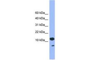 Image no. 1 for anti-Cell Division Cycle 26 Homolog (CDC26) (C-Term) antibody (ABIN6745280)