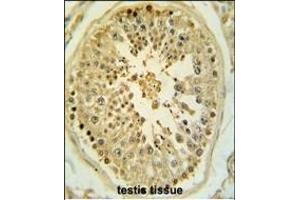 Formalin-fixed and paraffin-embedded human testis tissue reacted with LMX1B Antibody (Center), which was peroxidase-conjugated to the secondary antibody, followed by DAB staining. (LMX1B 抗体  (AA 175-202))