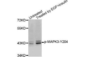 Western blot analysis of extracts from SK-BR-3 cells, using Phospho-MAPK3-Y204 antibody. (ERK1 抗体  (pTyr204))