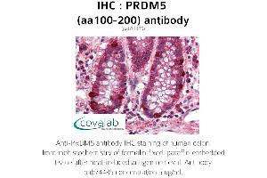 Image no. 1 for anti-PR Domain Containing 5 (PRDM5) (AA 100-200) antibody (ABIN1738318) (PRDM5 抗体  (AA 100-200))