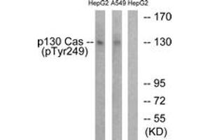 Western blot analysis of extracts from HepG2 cells treated with EGF 200ng/ml 30' and A549 cells treated with PMA 125ng/ml 30', using p130 Cas (Phospho-Tyr249) Antibody. (BCAR1 抗体  (pTyr249))