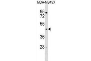 Western Blotting (WB) image for anti-Ring Finger Protein 128 (RNF128) antibody (ABIN3000884) (RNF128 抗体)