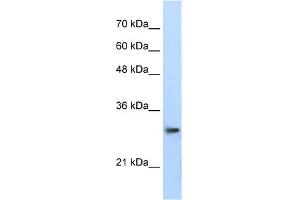Western Blotting (WB) image for anti-Proteasome Subunit alpha Type 1 (PSMA1) (C-Term) antibody (ABIN2778810)