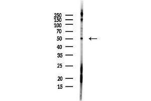 Western blot analysis of lysates from PC12 cells(LPS, 4h treatment), using Perilipin-1 Antibody at 1/1000 dilution.