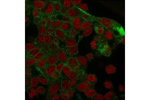 Immunofluorescence staining of PFA-fixed HepG2 cells with Catenin, gamma Mouse Monoclonal Antibody (rCTNG/1664) followed by goat anti-Mouse IgG-CF488 (Green). (Recombinant JUP 抗体)