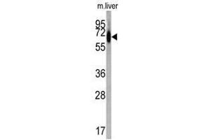 Image no. 1 for anti-Albumin (ALB) (C-Term) antibody (ABIN452731) (Albumin 抗体  (C-Term))