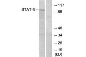 Western blot analysis of extracts from HeLa cells, using STAT6 (Ab-641) Antibody. (STAT6 抗体  (AA 608-657))