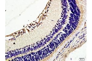 Formalin-fixed and paraffin embedded rat retina tissue labeled with Anti TIE2/CD202b Polyclonal Antibody, Unconjugated (ABIN674649) at 1:200 followed by conjugation to the secondary antibody and DAB staining