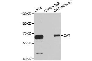 Immunoprecipitation analysis of 100ug extracts of HepG2 cells using 3ug CAT antibody. (Catalase 抗体  (AA 1-225))