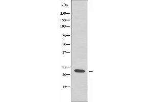 Western blot analysis of extracts from JurKat cells using RPS7 antibody. (RPS7 抗体  (C-Term))