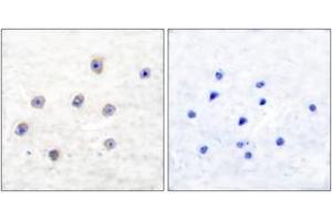 Immunohistochemistry analysis of paraffin-embedded human brain, using Tyrosine Hydroxylase (Phospho-Ser31) Antibody. (Tyrosine Hydroxylase 抗体  (pSer62))