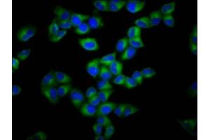 Immunofluorescence staining of Hela cells with ABIN7153647 at 1:133, counter-stained with DAPI. (Gasdermin A 抗体  (AA 64-172))