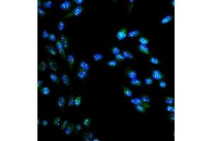 IF analysis of ARG2 using anti-ARG2 antibody (ABIN7599304).
