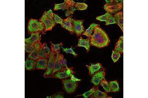 Immunofluorescence analysis of HepG2 cells using RBP4 mouse mAb (green).