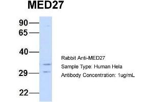 Host: Rabbit Target Name: MED27 Sample Type: Hela Antibody Dilution: 1. (MED27 抗体  (Middle Region))