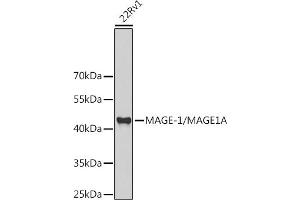Western blot analysis of extracts of 22Rv1 cells, using MAGE-1/MA antibody (ABIN6132325, ABIN6143435, ABIN6143436 and ABIN6221133) at 1:1000 dilution. (MAGEA1 抗体  (AA 1-309))