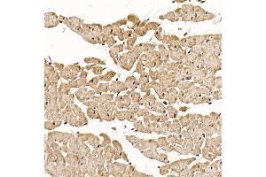 Immunohistochemistry of paraffin-embedded rat heart using RC Rabbit pAb (ABIN6129452, ABIN6146811, ABIN6146812 and ABIN6220955) at dilution of 1:150 (40x lens). (RCAN1 抗体  (AA 60-245))
