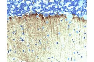 Immunohistochemical staining on rat cerebellum, formalin-fixed paraffin embedded tissue, with citrate pre-treatment (40X magnification). (ENAH 抗体  (AA 415-541))