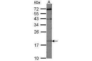 WB Image Sample (30 ug of whole cell lysate) A:NIH-3T3 12% SDS PAGE antibody diluted at 1:1000 (UBE2C 抗体)
