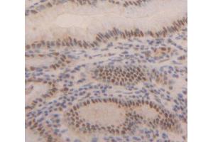 IHC-P analysis of Kidney tissue, with DAB staining. (MBD2 抗体  (AA 145-411))