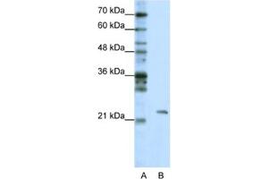 Western Blotting (WB) image for anti-Mitochondrial rRNA Methyltransferase 1 Homolog (MRM1) antibody (ABIN2462305) (MRM1 抗体)