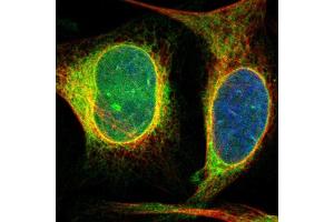 Immunofluorescent staining of human cell line U-2 OS shows localization to endoplasmic reticulum. (DERL1 抗体  (AA 186-251))