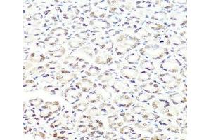 Immunohistochemistry (Paraffin-embedded Sections) (IHC (p)) image for anti-PRP8 Pre-mRNA Processing Factor 8 (PRPF8) antibody (ABIN7261922)