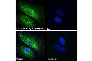 (ABIN238569) Immunofluorescence analysis of paraformaldehyde fixed U2OS cells, permeabilized with 0. (FGF21 抗体  (Internal Region))