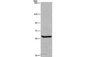 Western blot analysis of Raji cell, using MAGEL2 Polyclonal Antibody at dilution of 1:250 (MAGE-Like 2 抗体)