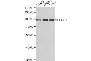 Western blot analysis of extracts of various cell lines, using SSRP1 antibody (ABIN2560151) at 1:1000 dilution. (SSRP1 抗体)