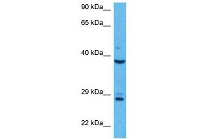 Host:  Rabbit  Target Name:  AGER  Sample Tissue:  Human MCF7 Whole Cell  Antibody Dilution:  1ug/ml (RAGE 抗体  (N-Term))