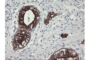Image no. 14 for anti-Src-like-adaptor 2 (SLA2) antibody (ABIN1500949)