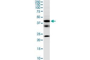 FCRLB monoclonal antibody (M01), clone 2F8. (FCRLB 抗体  (AA 89-174))