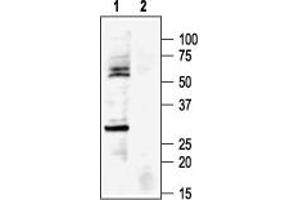 Western Blotting (WB) image for anti-Potassium Inwardly-Rectifying Channel, Subfamily J, Member 8 (KCNJ8) (AA 382-396), (Intracellular) antibody (ABIN7043489)