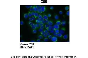 Sample Type :  Human Capan1 cells (Pancreatic cancer cell line)  Primary Antibody Dilution :  1:300  Secondary Antibody :   Anti-rabbit-AlexaFluor-488  Secondary Antibody Dilution :  1:200  Color/Signal Descriptions :  ZEB: Green DAPI: Blue  Gene Name :  ZEB1  Submitted by :  Dr. (ZEB1 抗体  (N-Term))