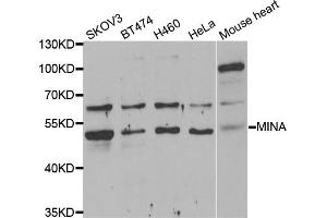 Western blot analysis of extracts of various cell lines, using MINA antibody (ABIN5974006) at 1/1000 dilution. (MINA 抗体)