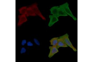 ABIN6259746 and ABIN6268898 staining Hela cells(30 min of UV treatment) by IF/ICC. (ACTG2 抗体  (N-Term))