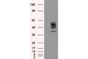 Image no. 3 for anti-Cytochrome P450, Family 1, Subfamily A, Polypeptide 2 (CYP1A2) antibody (ABIN1497712)