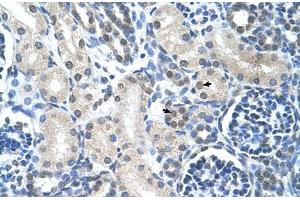 Immunohistochemical staining (Formalin-fixed paraffin-embedded sections) of human kidney with LOR polyclonal antibody . (LOR 抗体  (AA 58-107))