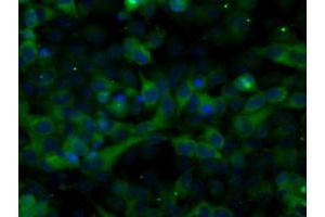 Image no. 9 for anti-Transforming, Acidic Coiled-Coil Containing Protein 3 (TACC3) antibody (ABIN1498097) (TACC3 抗体)