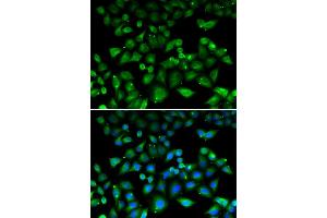 Immunofluorescence analysis of HeLa cell using NHLRC1 antibody. (NHLRC1 抗体)