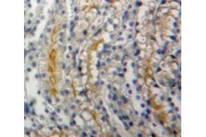 Used in DAB staining on fromalin fixed paraffin-embedded Kidney tissue (ADCY1 抗体  (AA 303-569))