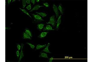Immunofluorescence of monoclonal antibody to HTRA2 on HeLa cell. (HTRA2 抗体  (AA 359-458))